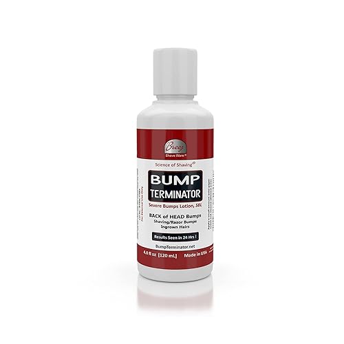 Breej Bump Terminator Severe Bumps Lotion, 4Oz - Fast Relief For Skin Bumps And Irritation