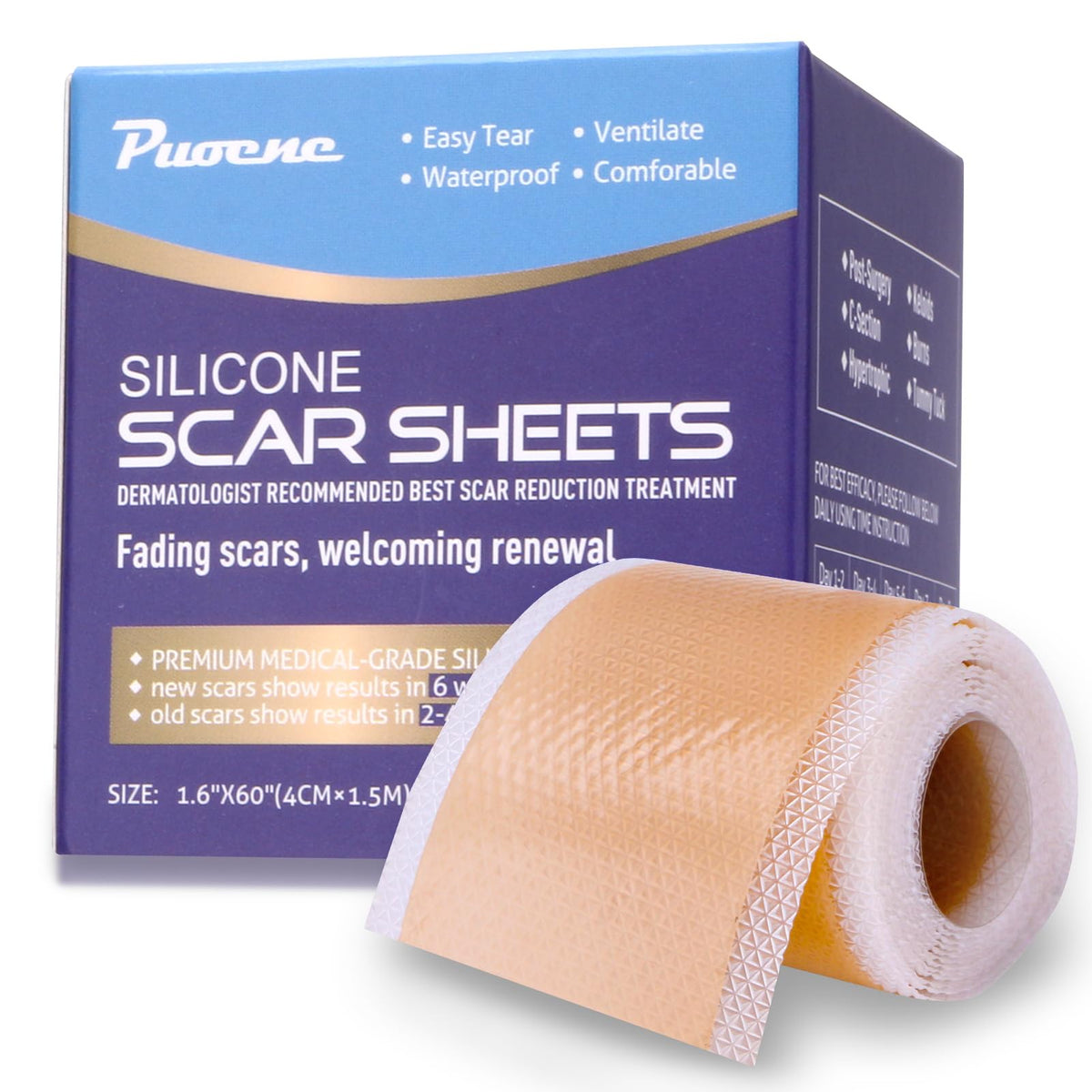 Puoene Silicone Scar Sheets - 1.6&quot; X 59&quot; Roll, Reusable Tape For C-Section, Burns,