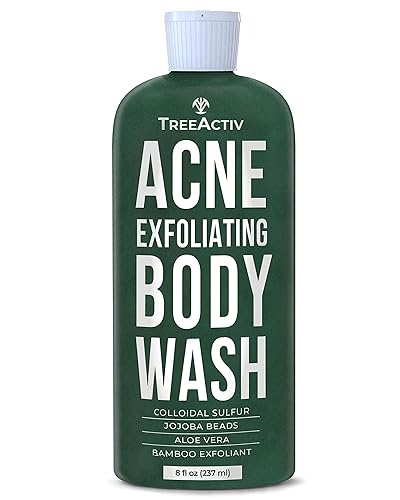 Treeactiv Acne Exfoliating Body Wash, Foam Cleanser With Sulfur & Aloe Vera, 8Oz