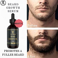 Striking Viking Beard Growth Oil with Biotin - Thickening and Conditioning Beard Oil - All Natural Beard Growth Serum Promotes Facial Hair Growth for Men, Sandalwood