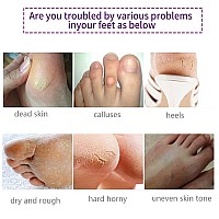 Foot Peel Masks for Dry Cracked Feet 5 Pack ,Exfoliating Foot Mask, Natural Exfoliator for Dead Skin, Callus, Repair Rough Heels for Men Women ,Make your Foot Baby Soft in 7 Days, AlIVER (4 - 12 )