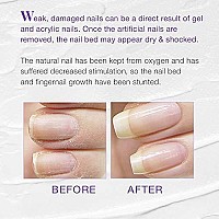 Nail Tek Xtra 4, Nail Strengthener for Weak and Damaged Nails, 0.5 oz, 1-Pack