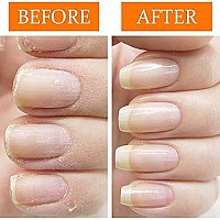 Nail Tek Nail Recovery Kit, Cuticle Oil, Strengthener, Ridge Filler - Restore Damaged Nails in 3 Steps