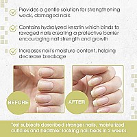 Nail Tek Nail Nutritionist, Keratin Enriched Nail Treatment Oil for Weak and Damaged Nails, 0.5 oz, 1-Pack