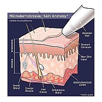 NeedCrystals Microdermabrasion Crystals for Machines, All-Natural Facial Exfoliating Treatment for Dull or Dry Skin, Wrinkles, Blemishes, Scars & More (4 lb, 120 Grit)