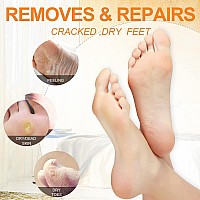 Foot Soak, Pedicure Spa Foot Bath Soak With Foot Soak Salt Scrub Lotion 4 In 1 Spa Pedicure Soak Set For Dry Cracked Feet, Moisturizing Foot Soak Spa Kit Honey Flower