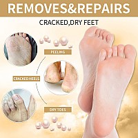 Pedicure Foot Soak Salt For Dry Feet Foot Spa Kit At Home (4_Honey Pearl)