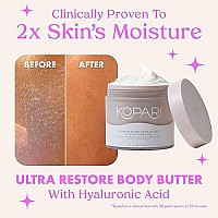 Kopari Ultra Restore Body Butter With Hyaluronic Acid, Vitamin B5 And Coconut Oil For Long-Lasting Hydration Silky Smooth Moisturizing Body Lotion For Dry Skin Vegan And Cruelty-Free 77 Oz