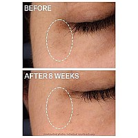 Super-C Dark Circle Brightening Eye Serum, Lightweight Gel Serum, Visibly Brightens And Corrects Dark Circles