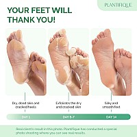 Plantifique Foot Peel Mask With Lavender 2 Pack Peeling Foot Mask Dermatologically Tested - Repairs Heels, Removes Dead Skin For Baby Soft Feet - Exfoliating Foot Mask For Dry Cracked Feet