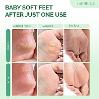 Plantifique Foot Peel Mask With Lavender 2 Pack Peeling Foot Mask Dermatologically Tested - Repairs Heels, Removes Dead Skin For Baby Soft Feet - Exfoliating Foot Mask For Dry Cracked Feet