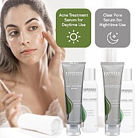 Exposed Skin Care Basic Acne Treatment Kit Includes Salicylic Acid Face Wash Clearing Tonic Treatment Serum With Benzoyl Per