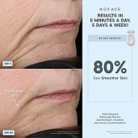 Nuface Fda Cleared Effective Lip Eye Attachment For Trinity Microcurrent Facial Device At Home Eye Lift Smile Lines Treatm