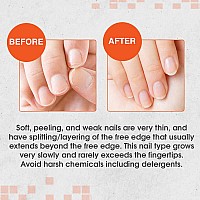 Nail Tek Intensive Therapy 2, Nail Strengthener for Soft and Peeling Nails, 0.5 oz x 2-Pack