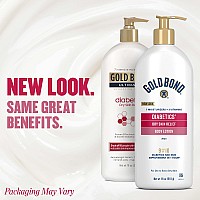 Gold Bond Diabetics Dry Skin Relief Body Lotion 18 Oz With Aloe To Moisturize Soothe