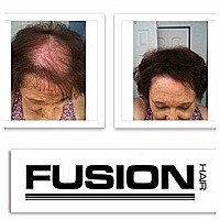 Hair Fusion 100 Real Human Hair Fibers Conceal Bald And Thinning Hair Root Touch Up Volumizer Unisex 105 Ounce Aub