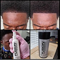 Hair Fusion 100 Real Human Hair Fibers Conceal Bald And Thinning Hair Root Touch Up Volumizer Unisex 105 Oz Black