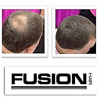 Hair Fusion 100 Real Human Hair Fibers Conceal Bald And Thinning Hair Root Touch Up Volumizer Unisex 043 Ounce Gre