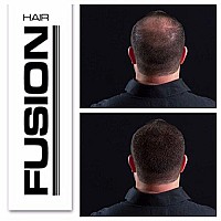 Hair Fusion 100 Real Human Hair Fibers Conceal Bald And Thinning Hair Root Touch Up Volumizer Unisex 105 Ounce Blo