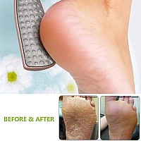 Bezox Foot File Callus Remover Double Sided Foot Scrubber For Dead Skin Stainless Steel Pedicure File For Cracked Heel Wcloth