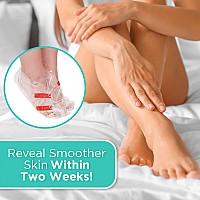 Dermora Exfoliating Foot Peel Mask For Baby Soft Feet Dry Cracked Callus Dead Skin Remover Coconut Scent 2 Pack Of Regular