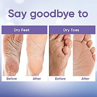 Foot Peel Mask 2 Pairs For Baby Soft Skin Remove Dead Skin Dry Cracked Feet Callus Spa Made With Aloe Vera Extract Wom