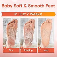 Foot Peel Mask 2 Pairs Foot Mask For Baby Soft Skin Remove Dead Skin Dry Cracked Feet Callus Foot Spa Made With Aloe