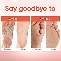 Foot Peel Mask 2 Pairs Foot Mask For Baby Soft Skin Remove Dead Skin Dry Cracked Feet Callus Foot Spa Made With Aloe