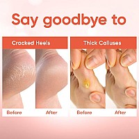 Foot Peel Mask 2 Pairs Foot Mask For Baby Soft Skin Remove Dead Skin Dry Cracked Feet Callus Foot Spa Made With Aloe