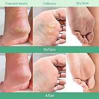 Plantifique Foot Peeling Mask Peeling Foot Mask Dermatologically Tested Repairs Heels Removes Dry Dead Skin For Baby Soft Fe