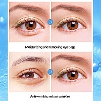 Liyalan Hyaluronic Under Eye Patches For Dark Circles And Puffiness Eye Mask Skin Care Products Eye Patches For Puffy Eyes Beaut