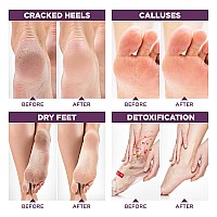 Lavinso Lavender Foot Exfoliator Peeling Mask For Dry Cracked Feet 3 Pack Remove Dead Skin And Callus Foot Peel Mask For B