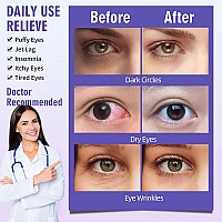 Serfeymi 10PCS Steam Eye Masks Relief Eye Fatigue,Hot Compress Self Heating Warm Eye Mask,Disposable Eye SPA Heated Eye Mask for Dry Eyes Dark Circles Tired Eyes -Lavender(5PCS)+ Chamomile(5PCS)