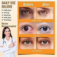 Serfeymi 10 Packs Steam Eye Masks Relieve Eye Fatigue, Eye Patch Self Heating Warm Eye Mask, Disposable Eye SPA Heated Eye Mask for Dry Eyes, Dark Circles, Tired Eyes -Unscented(5PCS)+ Chamomile(5PCS)