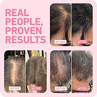 Boldify Hair Fibers 2 X 56G Fill In Fine And Thinning Hair For An Instantly Thicker Fuller Look Best Value Superior Form