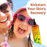 New After Sun Solar Recovery Spray With Aloe Vera For Skin Face With Instant Sunburn Relief Unlike Regular Aftersun Spray