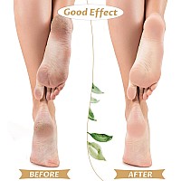 Tarpop 3 Pairs Aloe Socks Moisturizing Spa Socks For Dry Cracked Feet Infused Socks Gel Sleeping Fuzzy Socks Lotion Socks Gift F