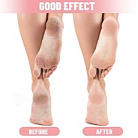 Tarpop 3 Pairs Aloe Socks Moisturizing Spa Socks For Dry Cracked Feet Infused Socks Gel Sleeping Fuzzy Socks Lotion Socks Gift F