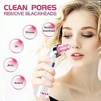 Blackhead Remover Pore Vacuum Face Suction Pore Cleanser 5 Suction Power Electric Blackhead Extractor Tool 4 Probes Blackhea