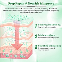 Nbc Beautilab Pedicure Foot Soak Set Upgraded 6 In 1 Foot Spa Foot Bath Spa Pedicure Kit Foot Soak For Tired Dry Cracked