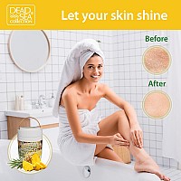 Dead Sea Collection Pineapple Body Butter For Women With Pure Dead Sea Minerals Nourishing Moisturizer Softening And Smoothi