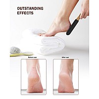 Bezox Foot Pumice Stone Pedicure File1 Pcs Wooden Handle Foot File Callus Remover For Smoother Feet And Hands Foot Scrubbe