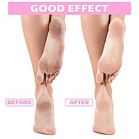 Tarpop 3 Pairs Aloe Socks Moisturizing Spa Socks For Dry Cracked Feet Infused Socks Gel Sleeping Fuzzy Socks Lotion Socks Gift F