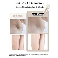 Laser Hair Removal Device For Women And Men Inia Fond Hair Remover With Longlasting In Hair Reduction For Bodyface Safe Ath