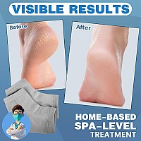 Teawoo 6 Pairs Moisturizing Heel Socks For Cracked Heel Treatment Foot Care Toeless Socks To Soften And Hydrate Dry Cracked Fee