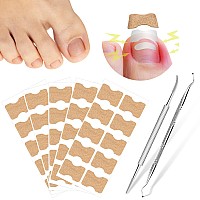 50 Pcs Breathable Corrector Patch Professional Pedicure For Ingrown Toenail Ingrown Toenail Corrector Patch 2 Pedicure Tools