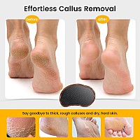 Bezox Glass Foot Scrubber1 Pcs Nanoglass Pedi Egg Pumice Stone For Feet Dead Skin Plasticfree Pedicure Foot File Callus R