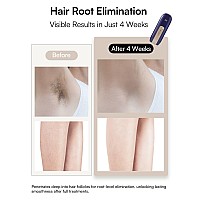 Laser Hair Removal Device For Women And Men Inia Fond Hair Remover With Longlasting In Hair Reduction For Bodyface Safe Ath