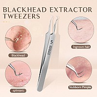 Wsyub Blackhead Tweezers Pimple Popper Tool Kit Blackhead Extractor Ingrown Hair Tweezers Blemish And Blackhead Removal Tools