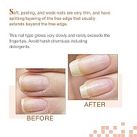 Nail Tek Intensive Therapy 2, Nail Strengthener for Soft and Peeling Nails, 0.5 oz Value 4-Pack